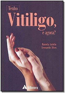 Livro Tenho vitiligo, e agora?