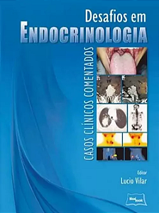 Livro Desafios Em Endocrinologia - Casos Clínicos Coment