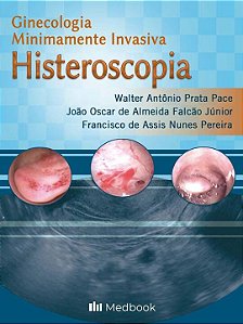 Livro Histeroscopia - Ginecologia Minimamente Invasiva - ...