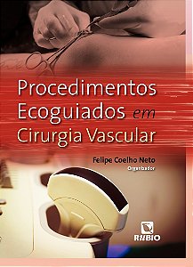 Livro Procedimentos Ecoguiados Em Cirurgia Vascular