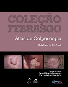 Livro Coleção Febrasgo - Atlas de colposcopia