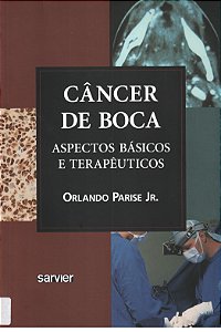 Câncer De Boca