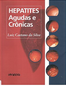 Hepatites Agudas E Crônicas