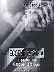 Ecoendoscopia Na Prática Da Gastroenterologia