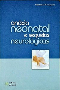 Anoxia Neonatal E Sequelas Neurologicas - 1
