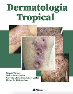 Livro - Dermatologia Tropical - Talhari/belda Junior