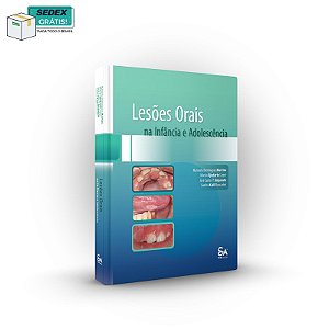 Livro Lesões Orais na Infância e Adolescência - Imparato - Santos Pub