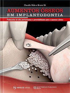 Livro Aumentos Osseos em Implantodontia: Protocolos de Alta Perfomance e Previsiv - Noia/sa