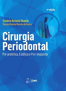Livro Cirurgia Periodontal Pré-protética, Estética e Peri-implantar: Duarte/Santos