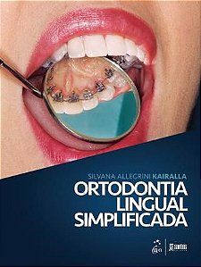 Livro - Ortodontia Lingual Simplificada - Kairalla