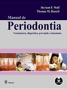 Livro Manual de Periodontia - Fundamentos, Diagnostico, Prevencao e Tratamento - Wolf/hassell