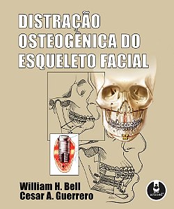 Livro Distracao Osteogenica do Esqueleto Facial - Bell/guerrero