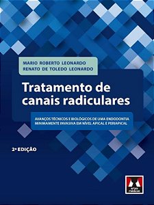 Livro Tratamento de Canais Radiculares - Leonardo