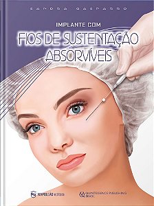 Livro - Implante com Fios de Sustentacao Absorviveis - Gasparro