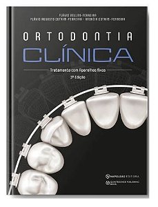 Livro Ortodontia Clínica - Tratamento com Aparelhos Fixos - Vellini - Napoleão
