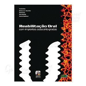 Livro Reabilitação Oral com Implantes Osseointegrados - Alves Neto