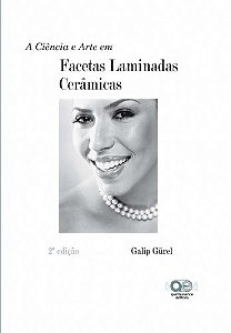 Livro Ciencia e Arte em Facetas Laminadas Ceramicas, A - Gurel
