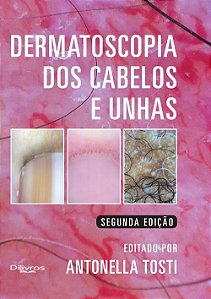 Livro Dermatoscopia dos Cabelos e Unhas - Tosti - Dilivros