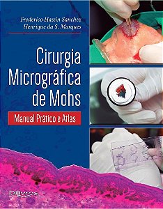 Cirurgia Micrográfica de Mohs - Sanchez - Dilivros