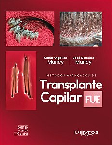 Livro Métodos Avançados de Transplante Capilar FUE - Muricy