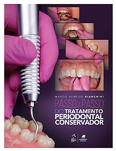 Livro Passo a Passo Tratamento Periodontal Conservador
