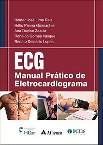 Ecg - Manual Prático De Eletrocardiograma
