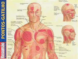 Resumão - Pontos-Gatilho