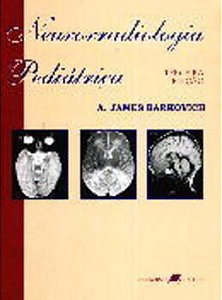 Neurorradiologia Pediátrica