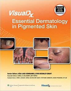 Visualdx - Essential Dermatology In Pigmented Skin