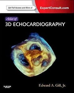 Atlas Of 3D Echocardiography - Expert Consult Online And Print