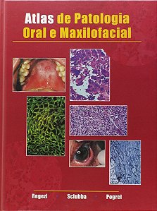 Atlas De Patologia Oral E Maxilofacial