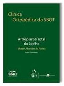 Clínica Ortopédica Da Sbotartroplastia Total Do Joelho
