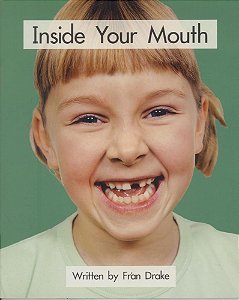 Inside Your Mouth! – 21