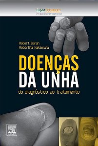 Doenças Da Unha - Do Diagnóstico Ao Tratamento