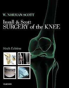 Insall & Scott Surgery Of The Knee - 2 Volumes - 6ª Edição