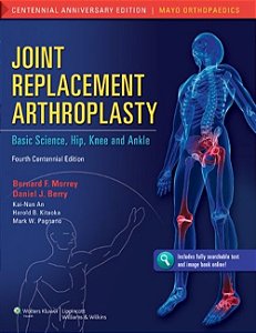 Joint Replacement Arthroplasty - Includes Online Access - Fourth Edition