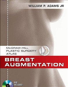 Breast Augmentation - Mcgraw-Hill Plastic Surgery Atlas