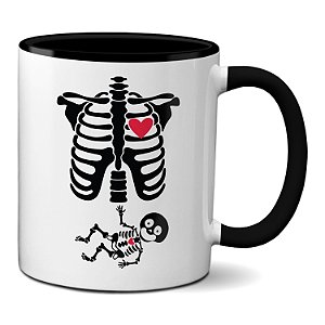 Caneca Mulher Grávida Raio X Bebê esqueleto Presente