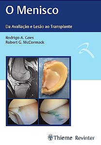 o Menisco - Da Avaliação e Lesão Ao Transplante