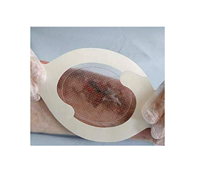 Curativo Filme Transparente Tegaderm 7,6cm x 9,5cm Absorvente Oval ref: 90800 - 3M