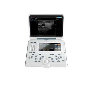 CONSOLE ULTRASSOM ESAOTE MYLAB ALPHA