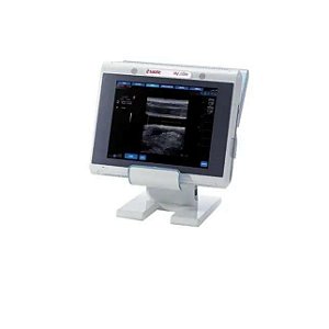 CONSOLE ULTRASSOM ESAOTE MYLAB ONE