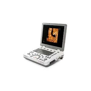 ULTRASSOM PORTATIL SAMSUNG MEDISON MY SONO U6 LIVE