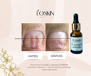 COMBO COM 10 UNIDADES - SERUM REPARADOR DE UNHAS EOSKIN - 15 ml