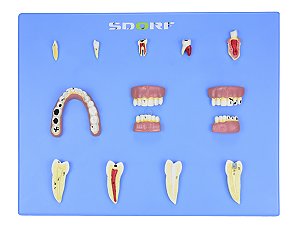Modelo de Patologias Dentárias c/ 12 Partes em Placa