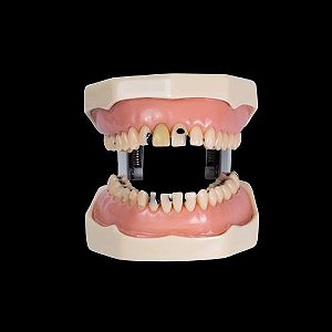 Manequim Dentística Cariado 32 Dentes removíveis