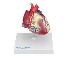 Modelo Patológico do Coração com Hipertrofia em 2 Partes