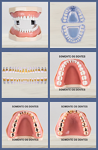 KIT 3 em 1 – Periodontia, Dentística e Materiais Dentários