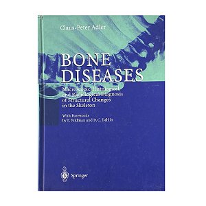 Bone Diseases - Claus-Peter Adler