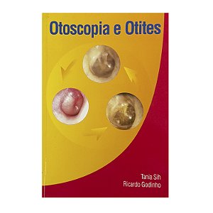 Otoscopia E Otites - Tania Sih/Ricardo Godinho